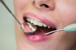 dentist examining a female patient with tools at dental clinic